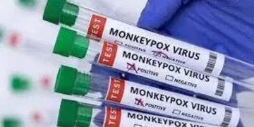 India’s 2nd monkeypox case: 31-year-old man from Kerala’s Kannur came from Dubai